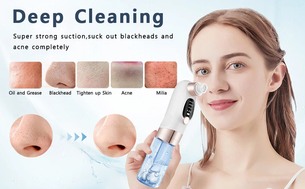 Electric Blackhead Remover Pore Vacuum