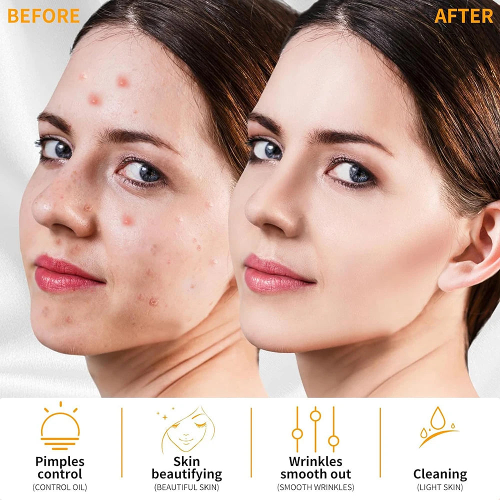 High Frequency Facial Wand