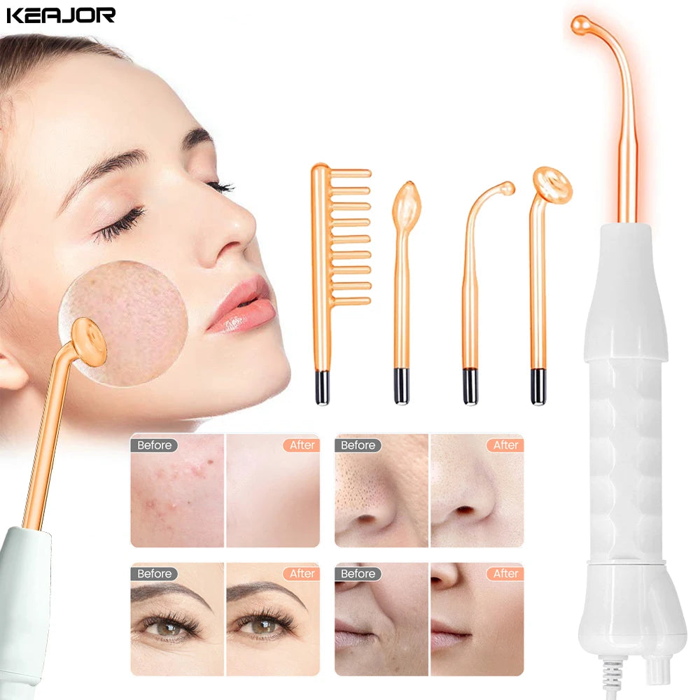 High Frequency Facial Wand