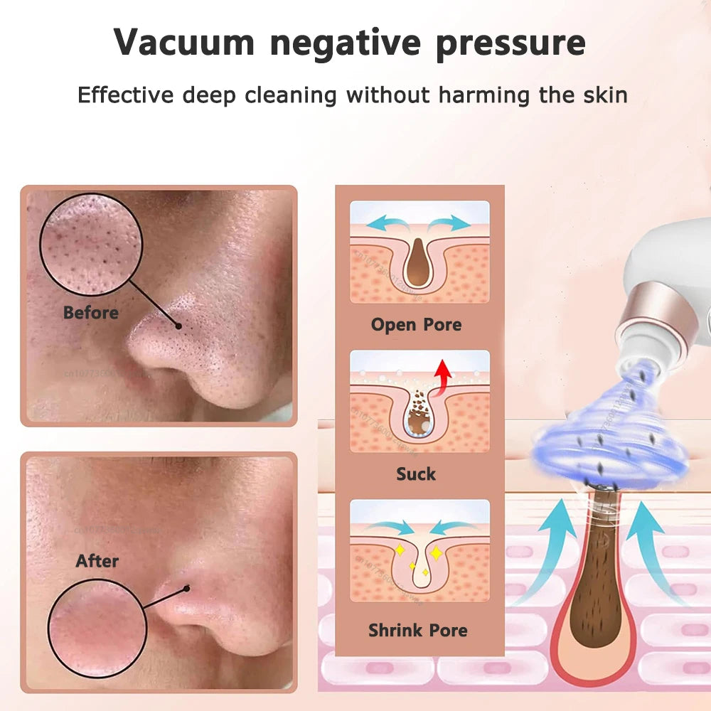 Electric Blackhead Remover Pore Vacuum